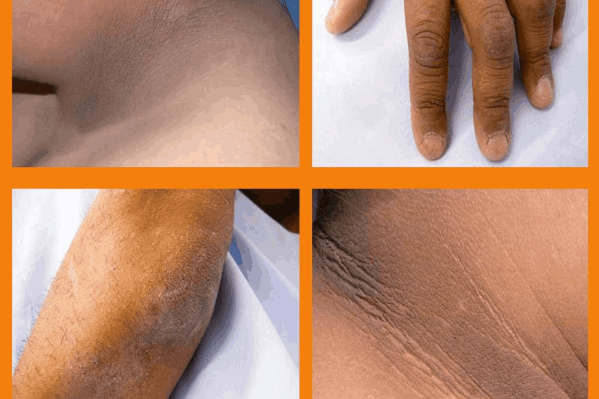 Which Treatment Is Best for Dark Knuckles?